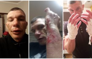 Gaz z butli wystrzelił i poparzył znanego świdnickiego sportowca