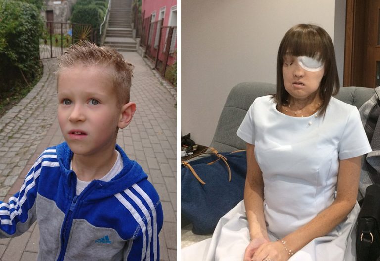 Komu 1% podatku? Wesprzyj Mikołaja i Joannę