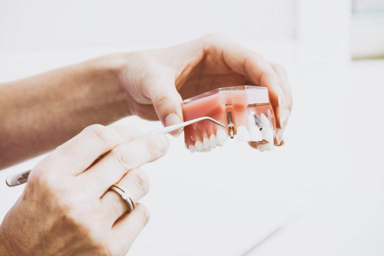 Protezy zębowe – piękny uśmiech na lata