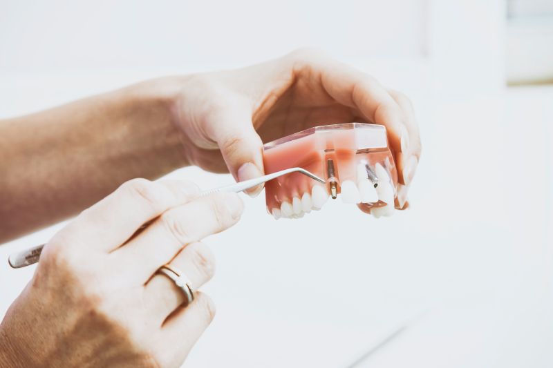 Implanty zębów a palenie tytoniu
