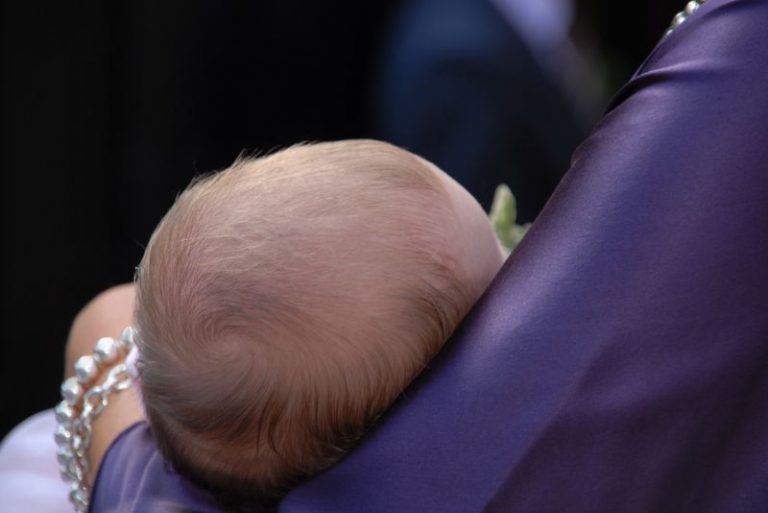 Jak wygląda ciemieniucha u dziecka?