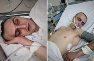 Dachował na ul. Kazimierza Wielkiego, dziś potrzebuje pomocy