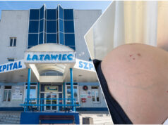 Świdniccy lekarze usunęli pacjentce guza ważącego 12 kilogramów