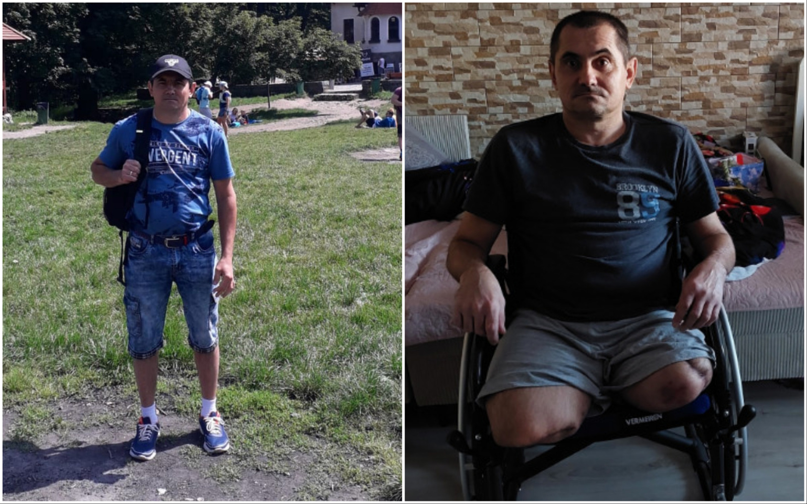 Stracił obie nogi w wypadku podczas pracy. Wsparcie można przekazać rozliczając się z fiskusem