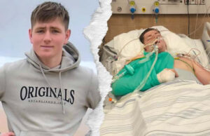 Stracił nogę w wyniku poważnego wypadku. 21-letni Kacper walczy o powrót do sprawności