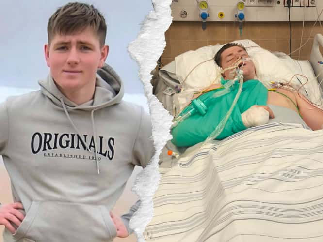 Stracił nogę w wyniku poważnego wypadku. 21-letni Kacper walczy o powrót do sprawności